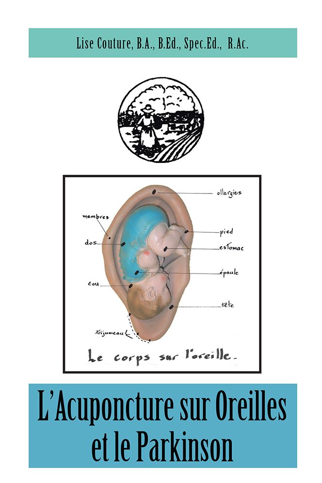 L'Acuponcture sur Oreilles et le Parkinson
