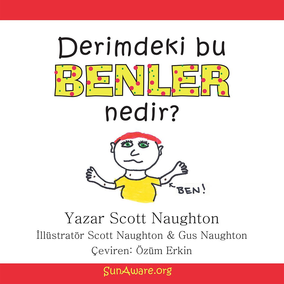 Derimdeki bu benler nedir?