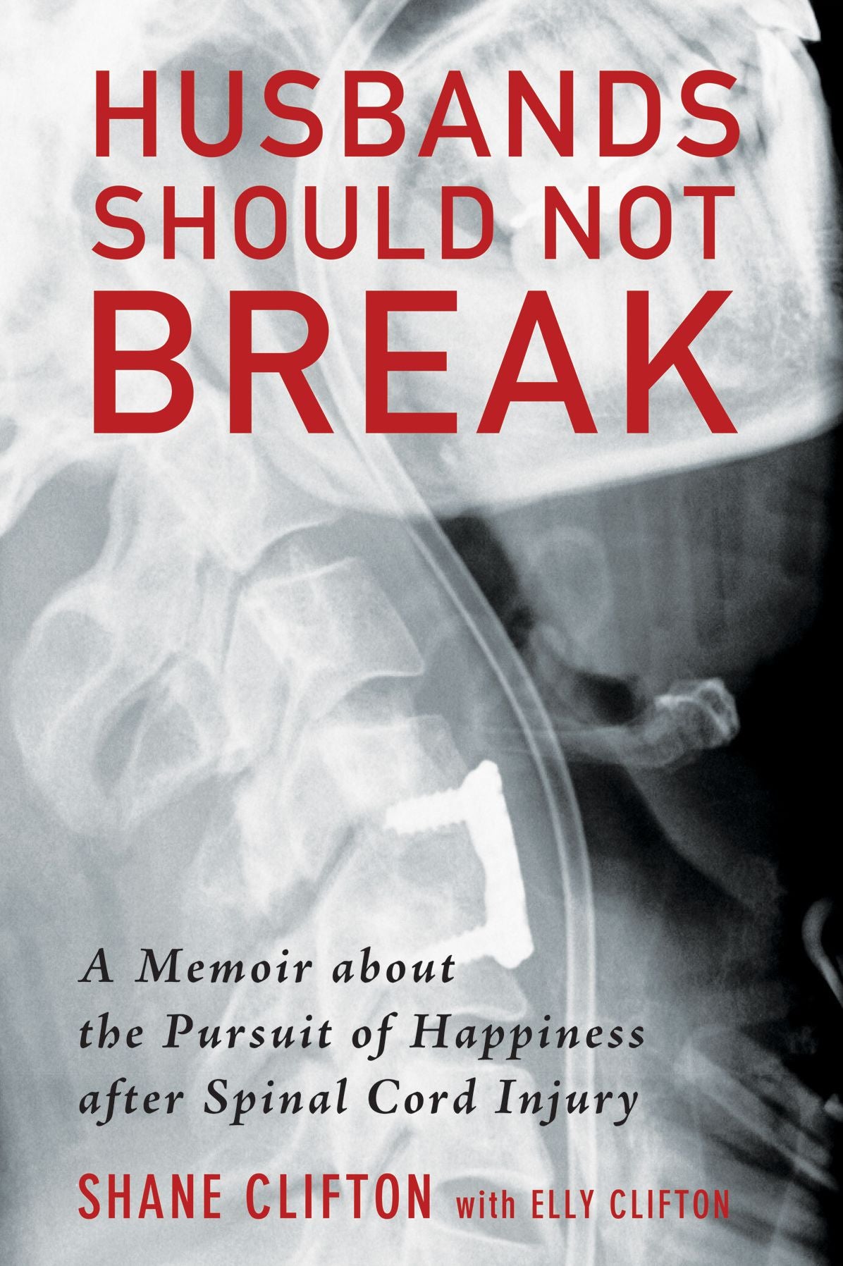 Husbands Should Not Break: A Memoir about the Pursuit of Happiness after Spinal Cord Injury