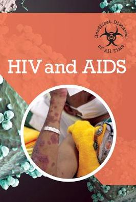 HIV and AIDS