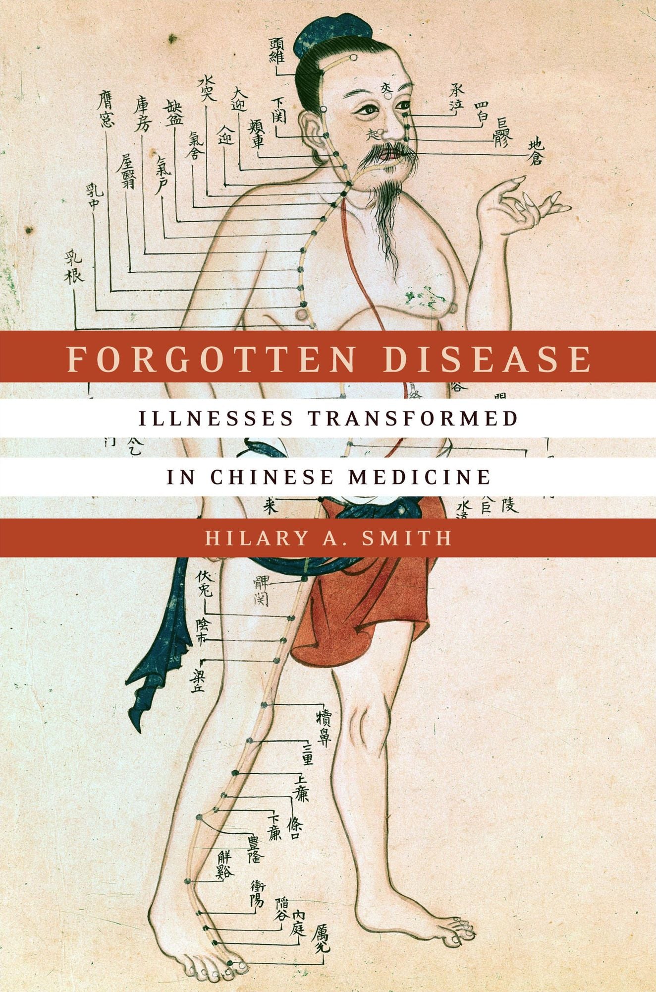 Forgotten Disease: Illnesses Transformed in Chinese Medicine