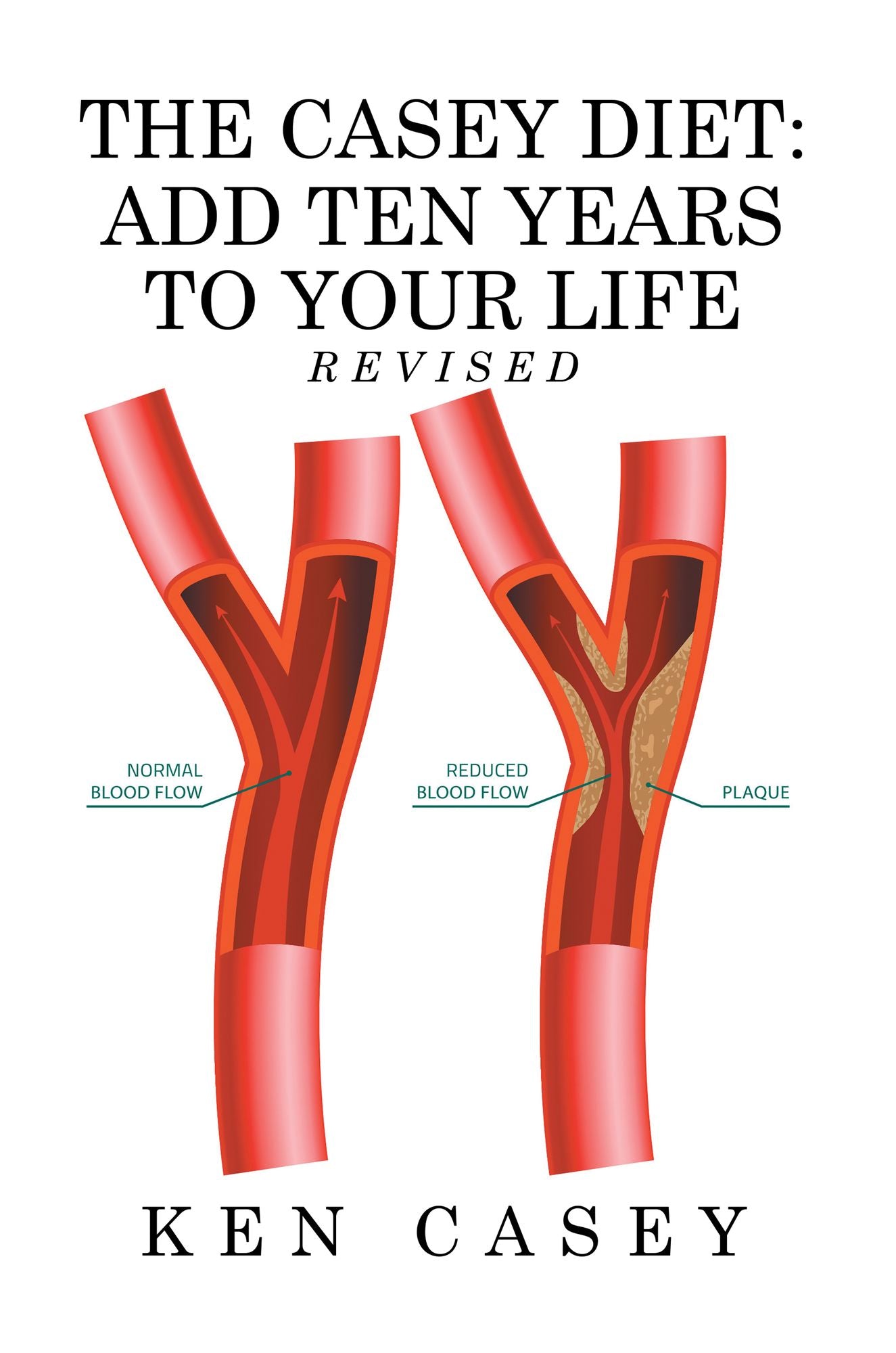 The Casey Diet: Add Ten Years to Your Life