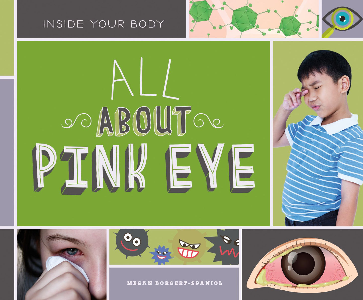 All about Pink Eye