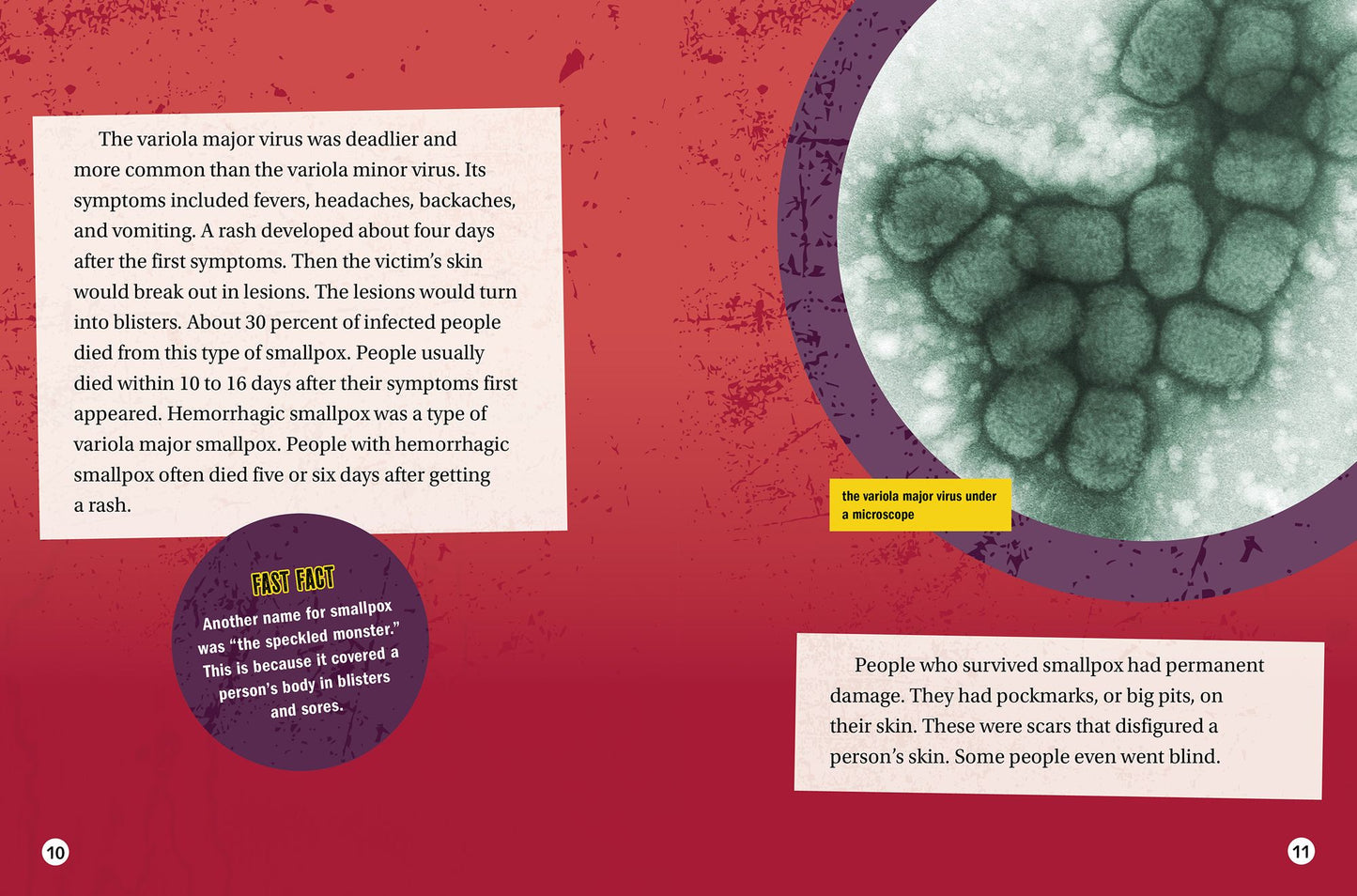 Smallpox: How a Pox Changed History