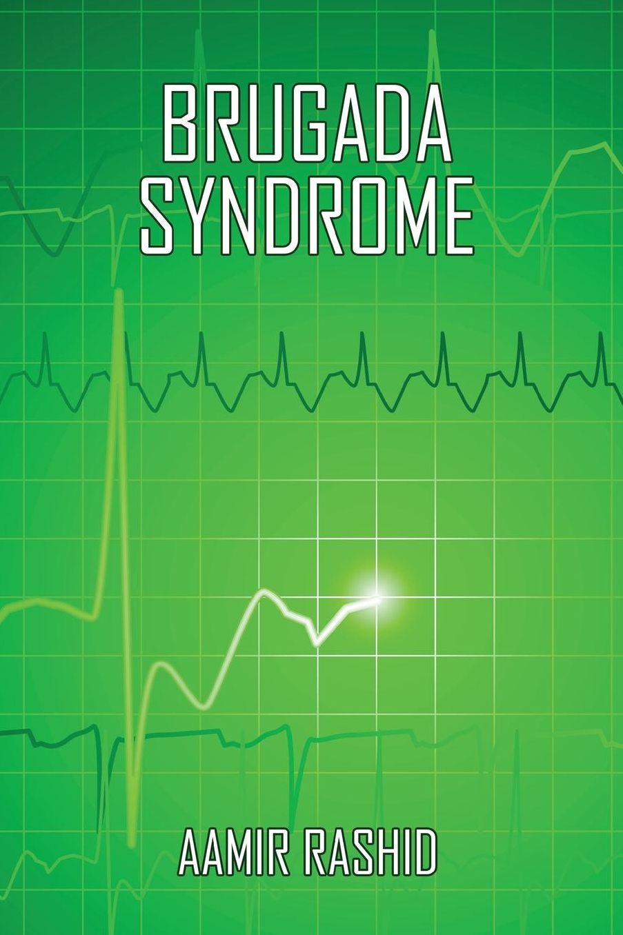 Brugada Syndrome