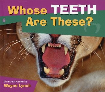 Whose Teeth Are These?