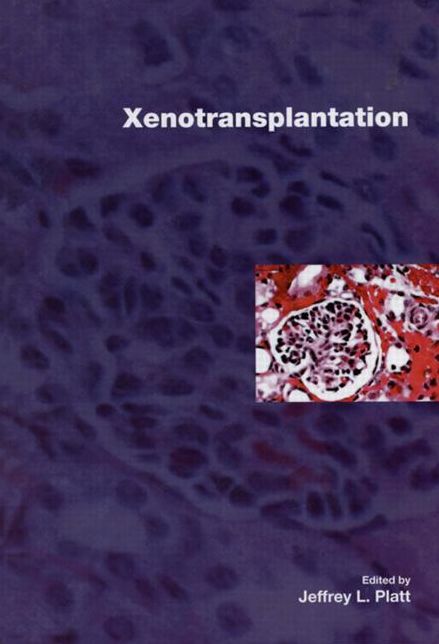 Xenotransplantation