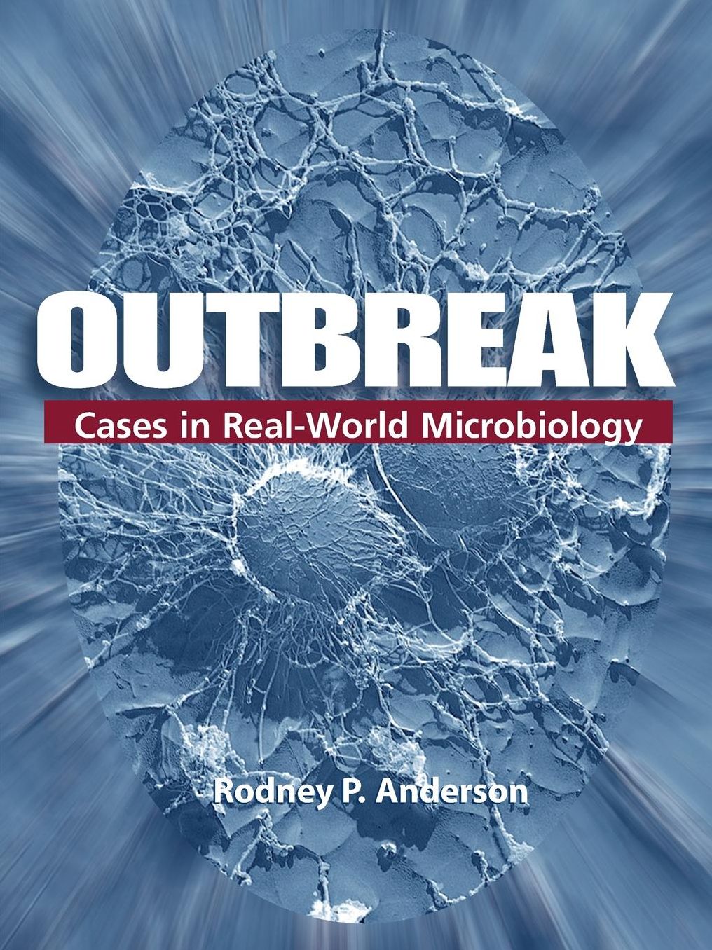 Outbreak: Cases in the Real-World Microbiology