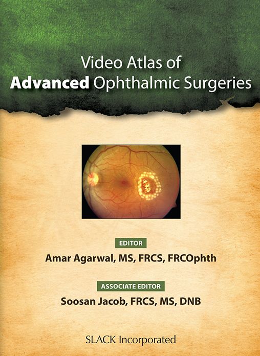 Video Atlas of Advanced Ophthalmic Surgeries
