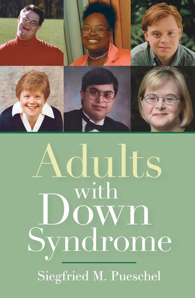 Adults with Down Syndrome