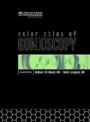 Color Atlas of Gonioscopy