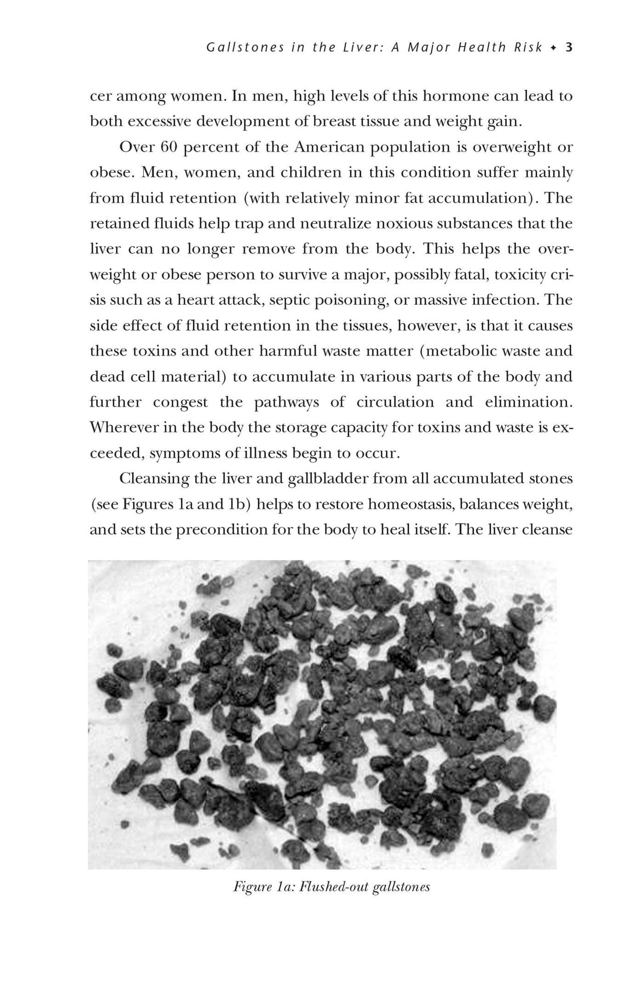 The Liver and Gallbladder Miracle Cleanse: An All-Natural, At-Home Flush to Purify and Rejuvenate Your Body