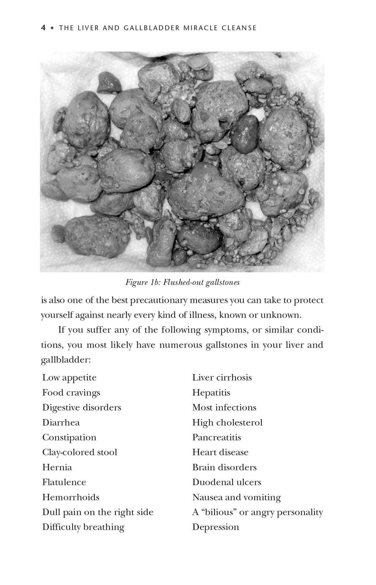 The Liver and Gallbladder Miracle Cleanse: An All-Natural, At-Home Flush to Purify and Rejuvenate Your Body
