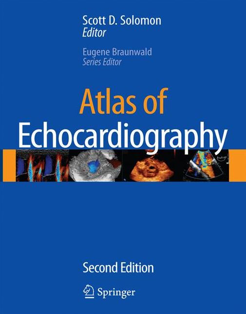 Atlas of Echocardiography