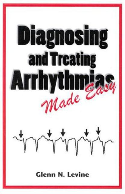 Diagnosing and Treating Arrhythmias Made Easy