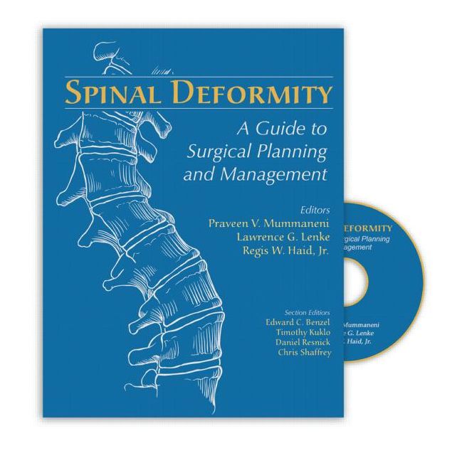 Spinal Deformity: A Guide to Surgical Planning and Management