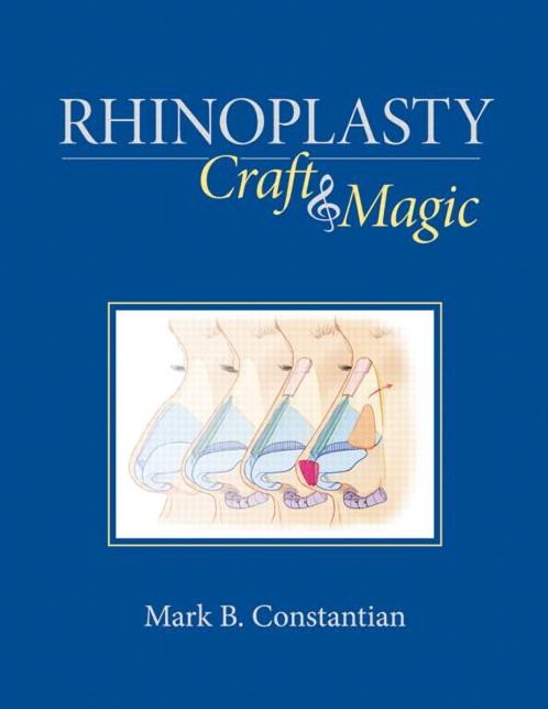 Rhinoplasty: Craft and Magic