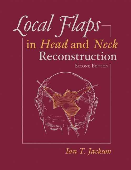 Local Flaps in Head and Neck Reconstruction