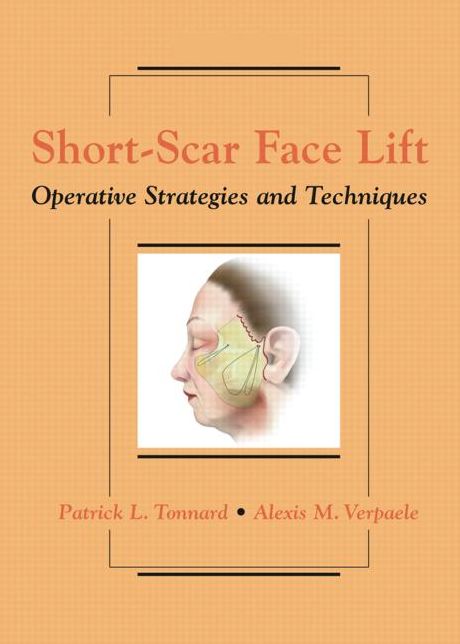 Short-Scar Face Lift: Operative Strategies and Techniques