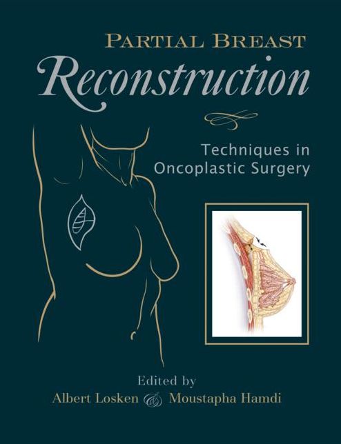 Partial Breast Reconstruction: Techniques in Oncoplastic Surgery