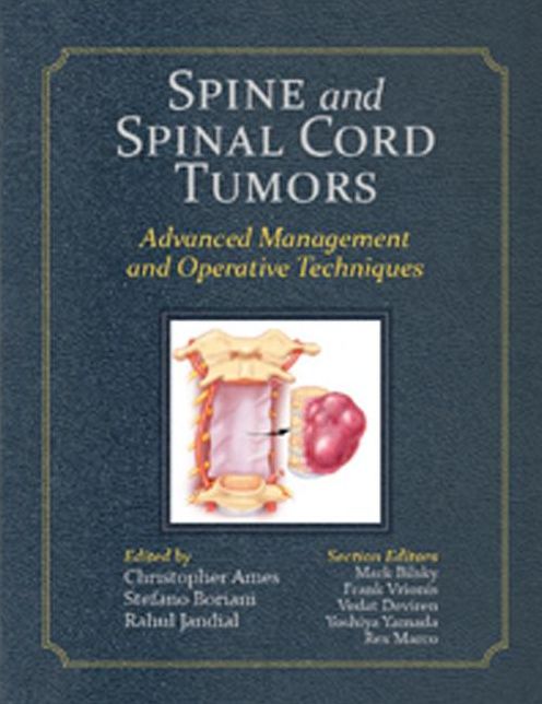 Spine and Spinal Cord Tumors: Advanced Management and Operative Techniques