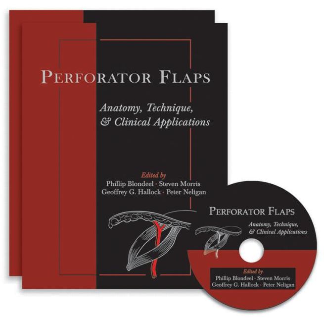 Perforator Flaps: Anatomy, Technique, & Clinical Applications, Second Edition