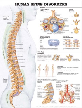 Human Spine Disorders Anatomical Chart