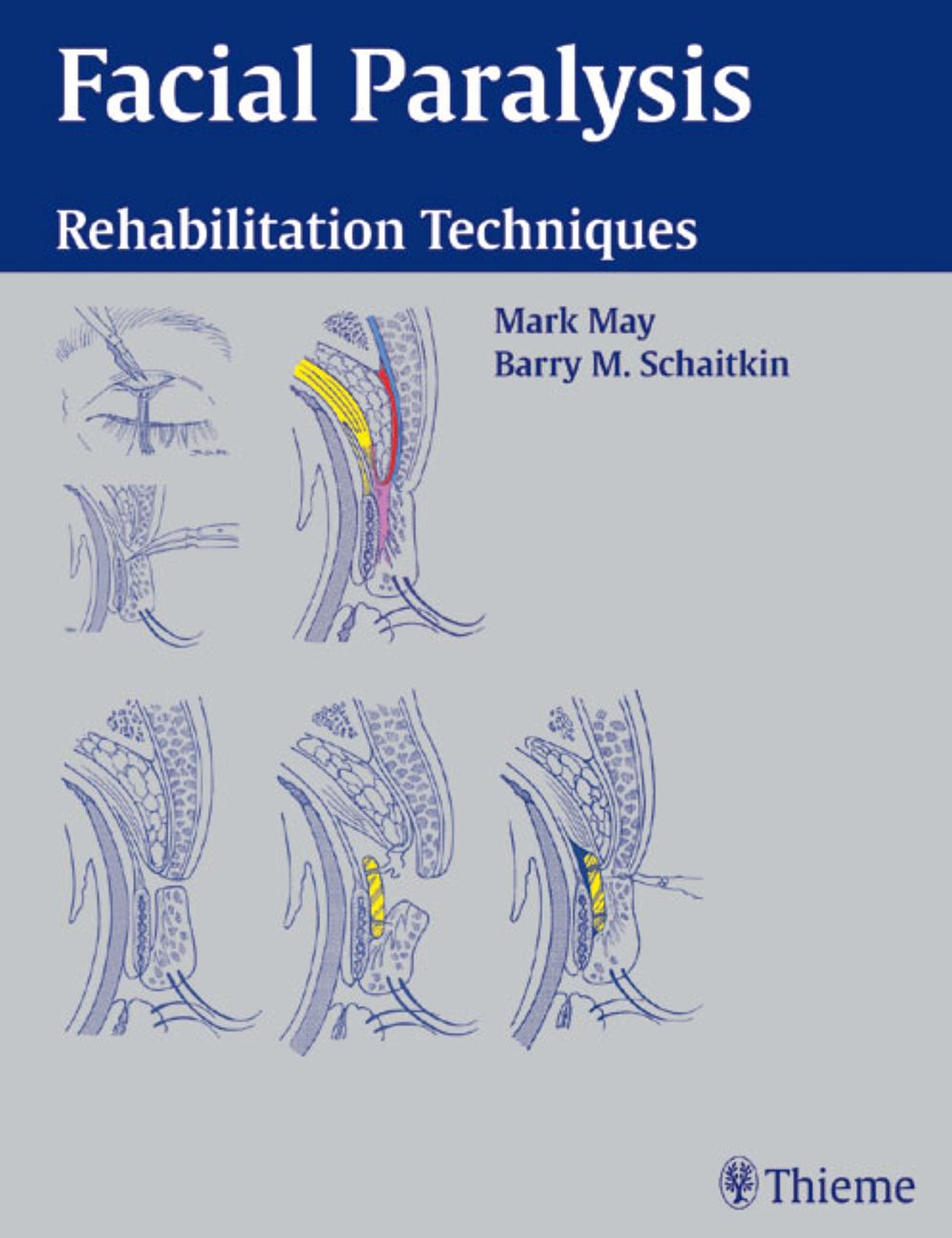 Facial Paralysis: Rehabilitation Techniques
