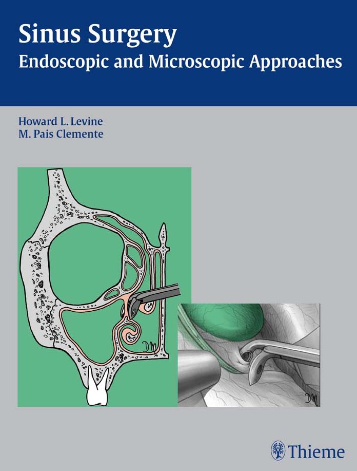 Sinus Surgery: Endoscopic and Microscopic Approaches