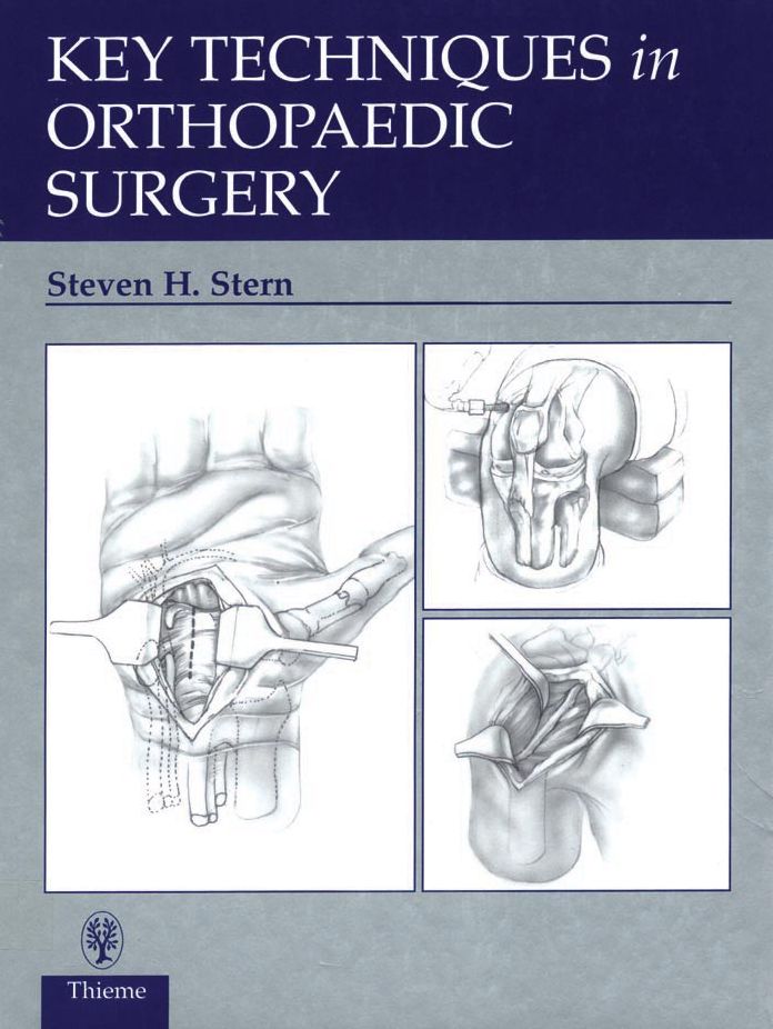 Key Techniques in Orthopaedic Surgery