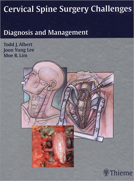 Cervical Spine Surgery Challenges: Diagnosis and Management