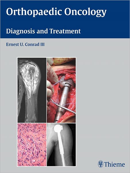 Orthopaedic Oncology: Diagnosis and Treatment