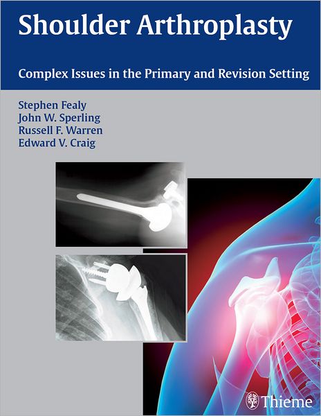 Shoulder Arthroplasty: Complex Issues in the Primary and Revision Setting