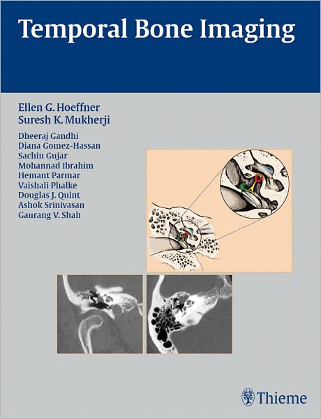 Temporal Bone Imaging