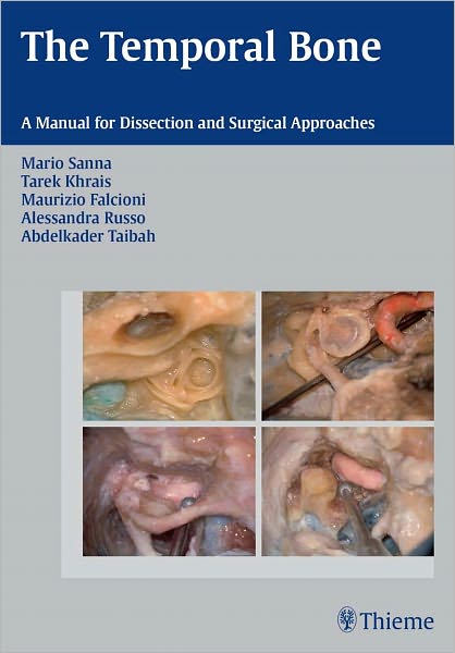 Temporal Bone: A Manual for Dissection and Surgical Approaches