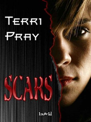 Scars