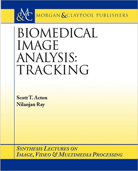 Biomedical Image Analysis: Tracking