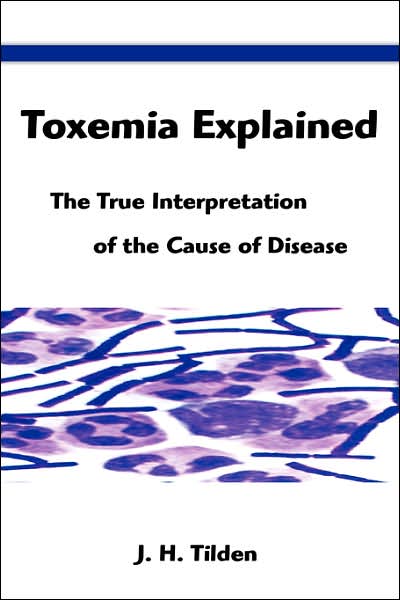 Toxemia Explained