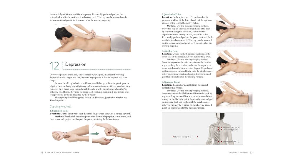 A Practical Guide to Cupping Therapy: A Natural Approach to Heal Through Traditional Chinese Medicine
