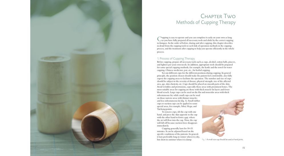 A Practical Guide to Cupping Therapy: A Natural Approach to Heal Through Traditional Chinese Medicine