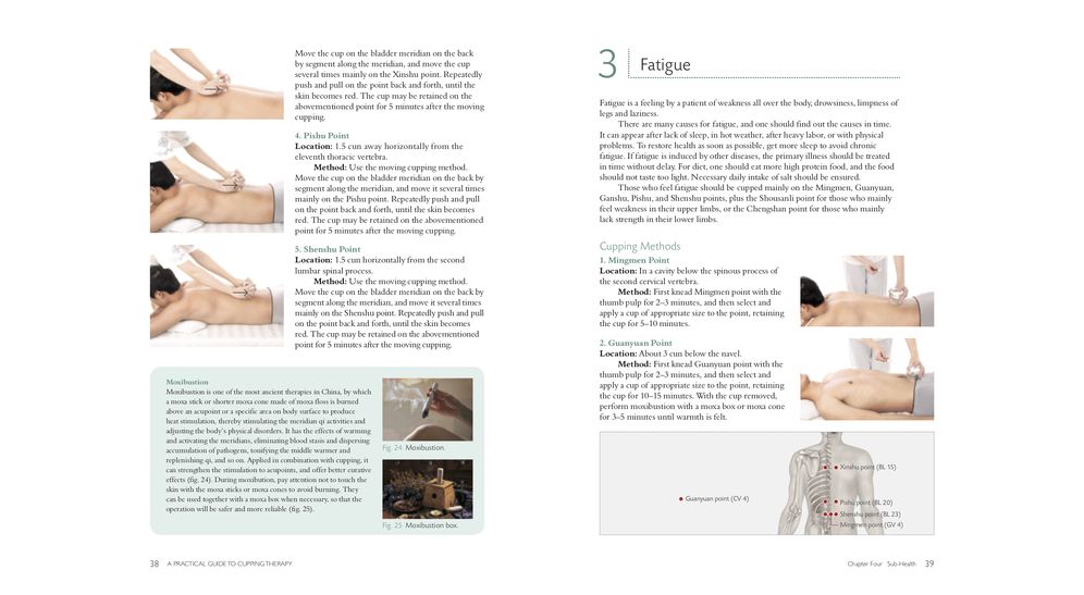 A Practical Guide to Cupping Therapy: A Natural Approach to Heal Through Traditional Chinese Medicine
