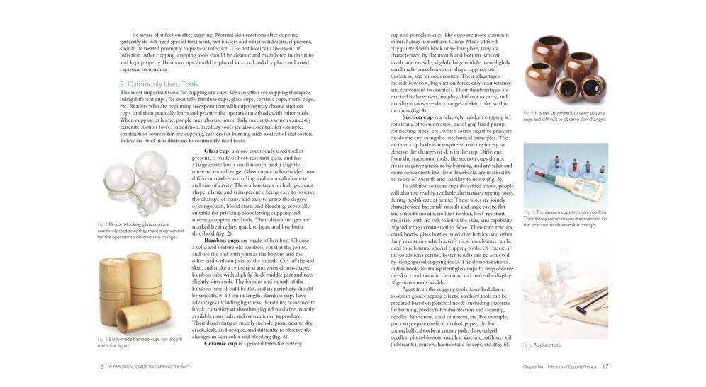 A Practical Guide to Cupping Therapy: A Natural Approach to Heal Through Traditional Chinese Medicine