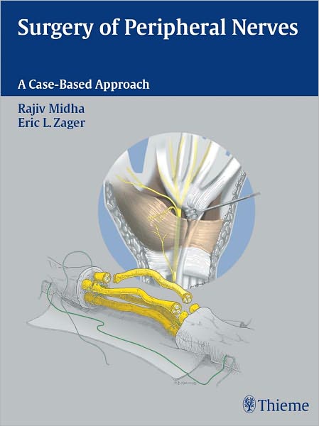 Surgery of Peripheral Nerves: A Case-Based Approach