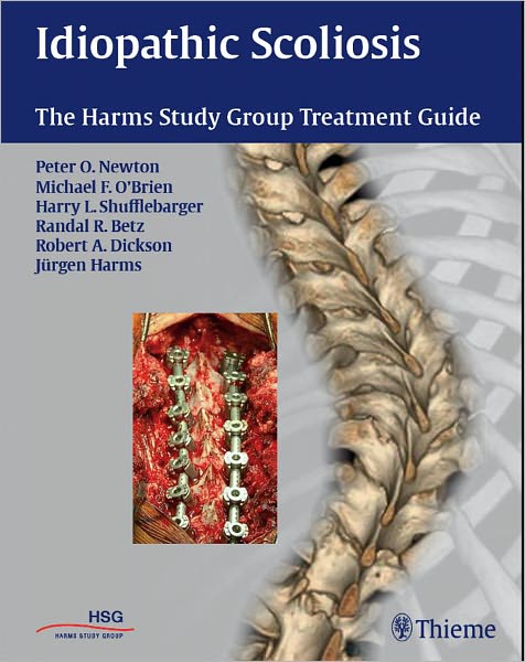 Idiopathic Scoliosis: The Harms Study Group Treatment Guide