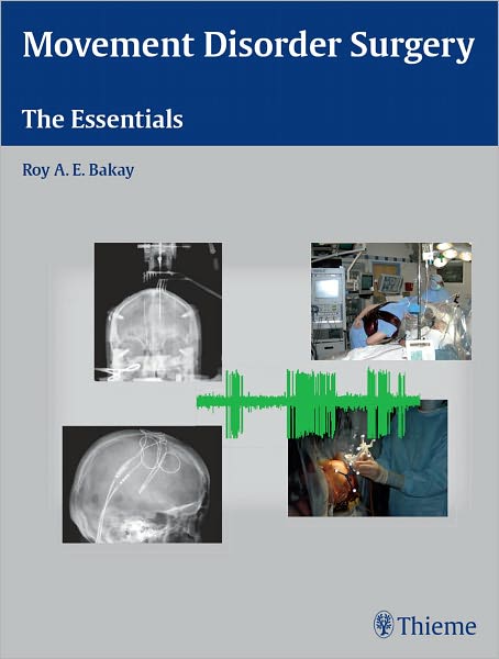 Movement Disorder Surgery: The Essentials