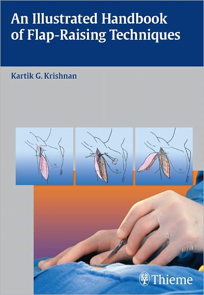 Illustrated Handbook of Flap-Raising Techniques