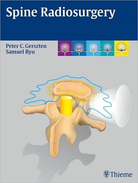 Spine Radiosurgery