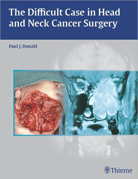 Difficult Case in Head and Neck Cancer Surgery