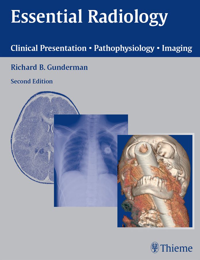 Essential Radiology: Clinical Presentation Pathophysiology Imaging