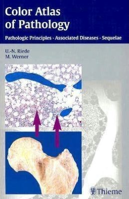 Color Atlas of Pathology: Pathologic Principles, Associated Diseases, Sequelae